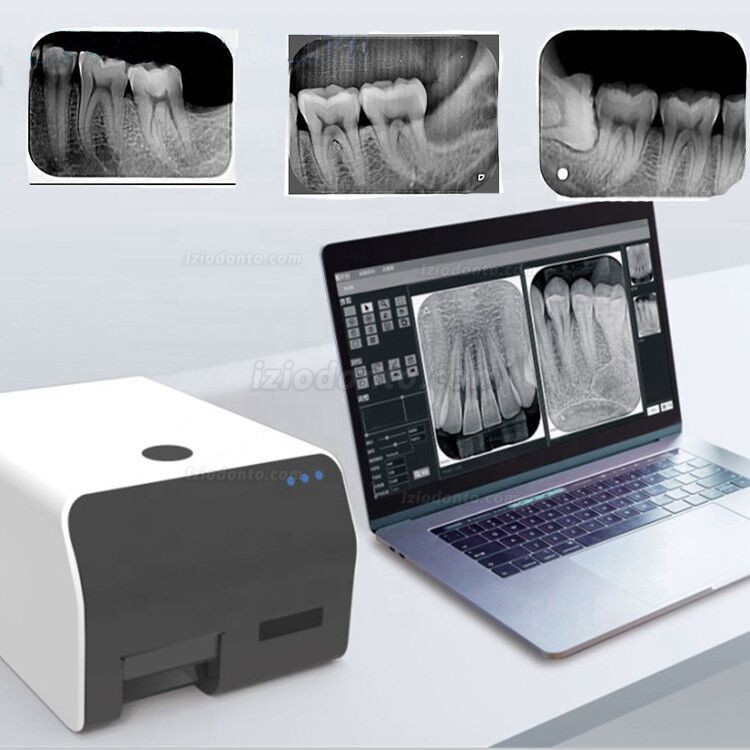 VRN EQ-600 Digital Scanner Dental Rx Placa De Fosforo Odontológica