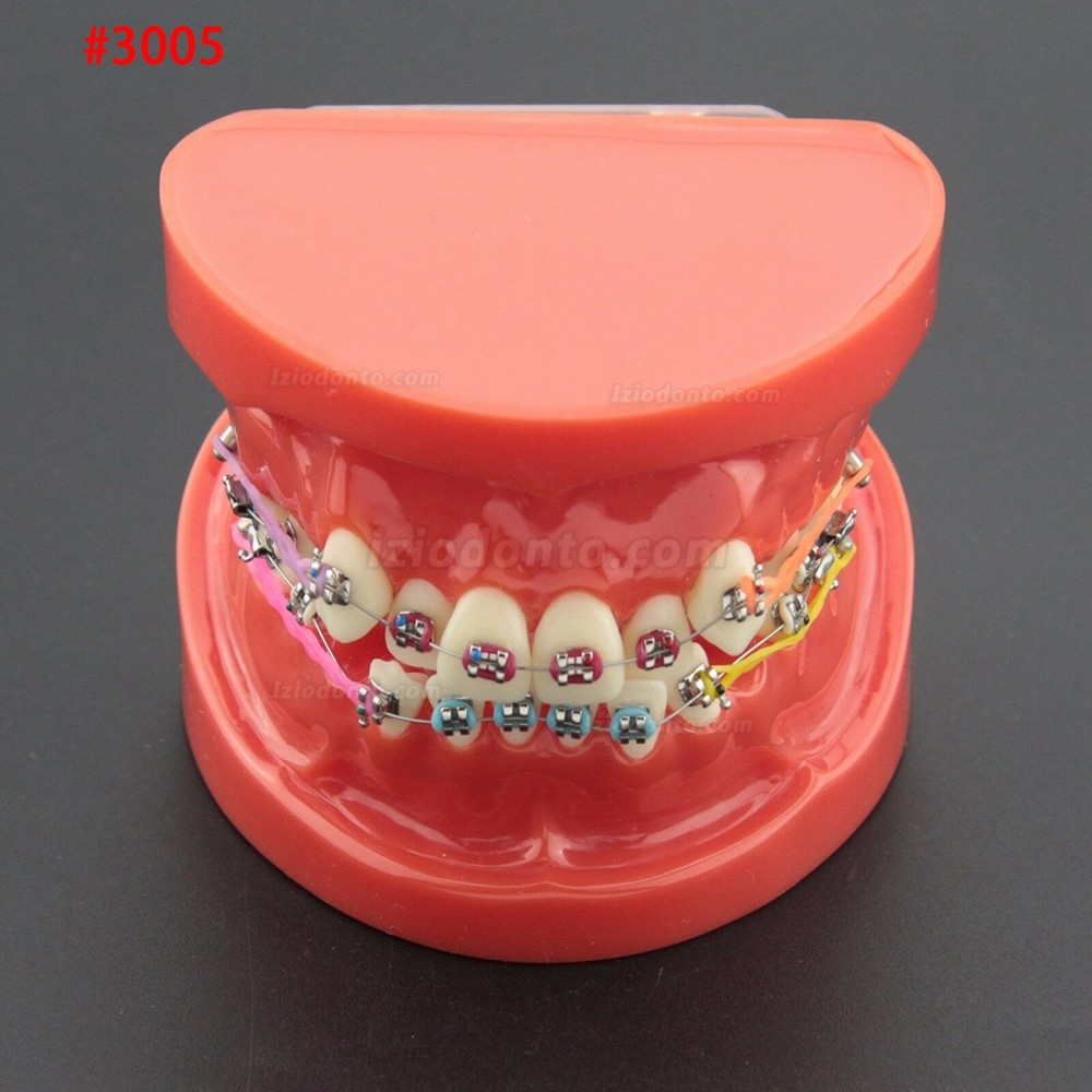 Modelo de Dentes de Prática de Demonstração de Tratamento Ortodôntico Odontológico