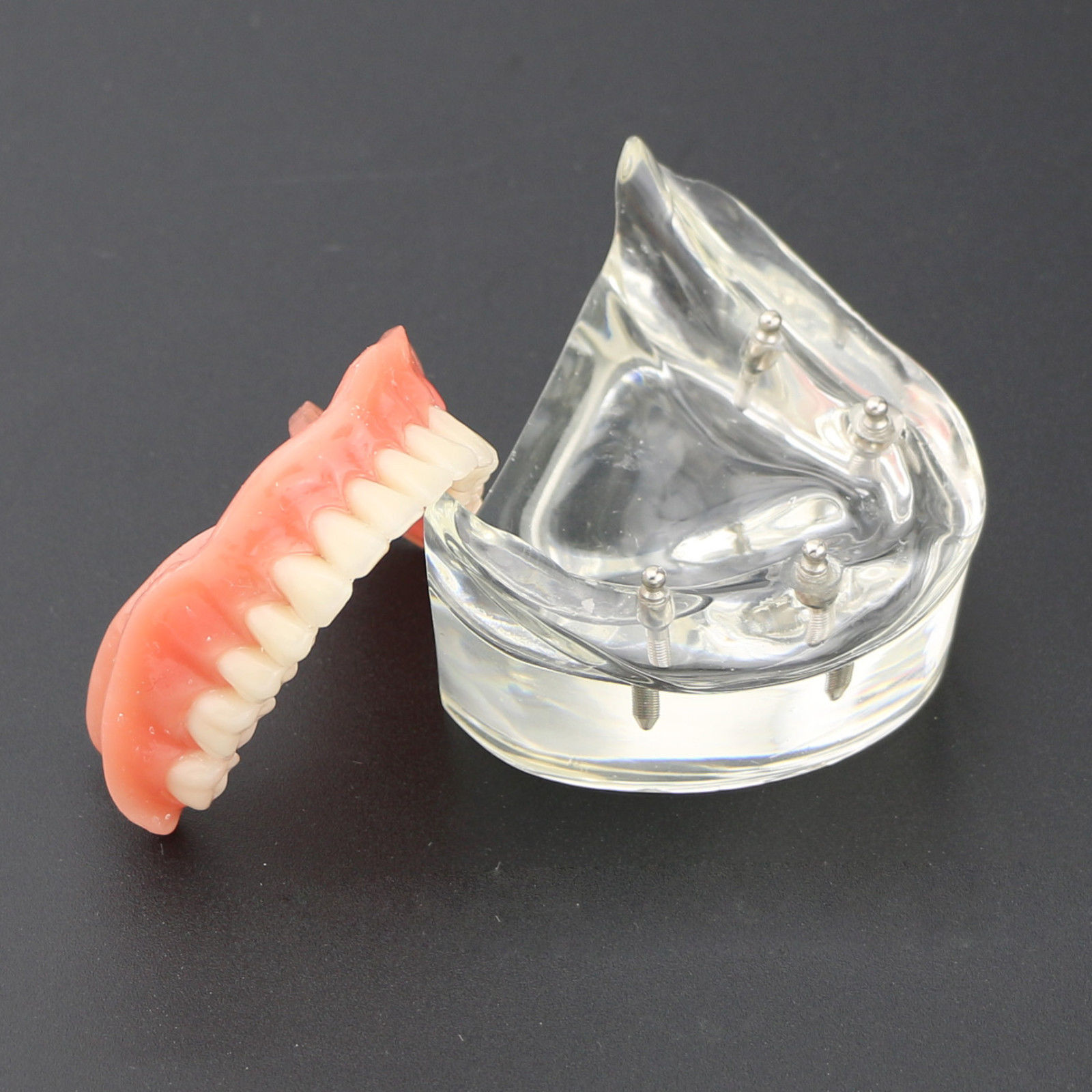 Dentes Inferiores Dentais Modelo 6002 02 Sobredentadura com 4 Implantes