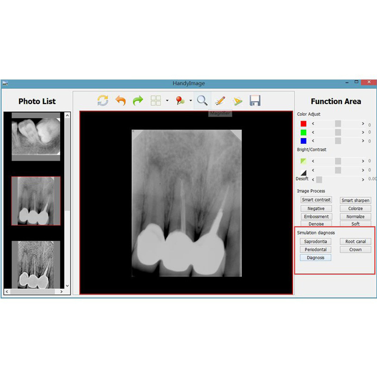 Alta resolução Tipo USB Digital Sensor Para Radiografia Odontológica Rvg HDR 500