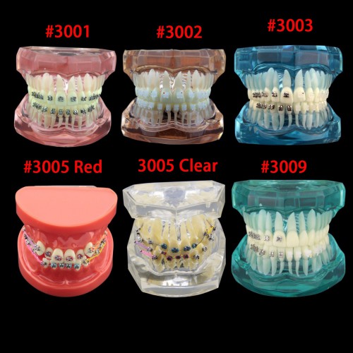 Modelo de Dentes de Prática de Demonstração de Tratamento Ortodôntico Odontológico