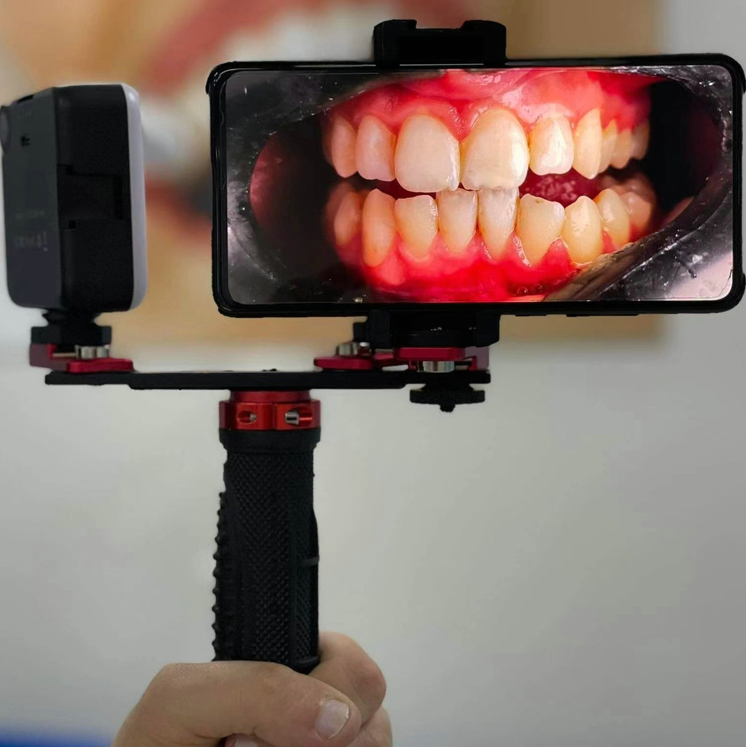 Luz de preenchimento para fotografia odontológica flash para fotografia odontológica para celular
