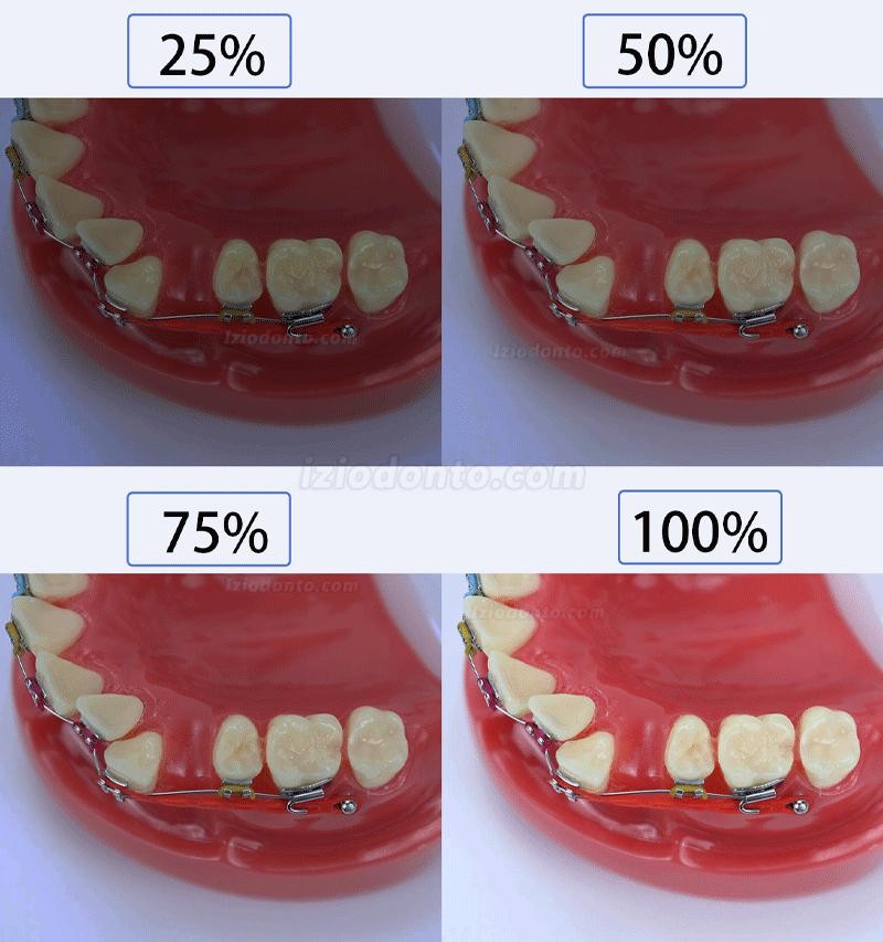 Luz de preenchimento para fotografia odontológica flash para fotografia odontológica para celular