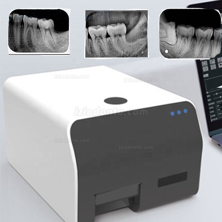 VRN EQ-600 Digital Scanner Dental Rx Placa De Fosforo Odontológica