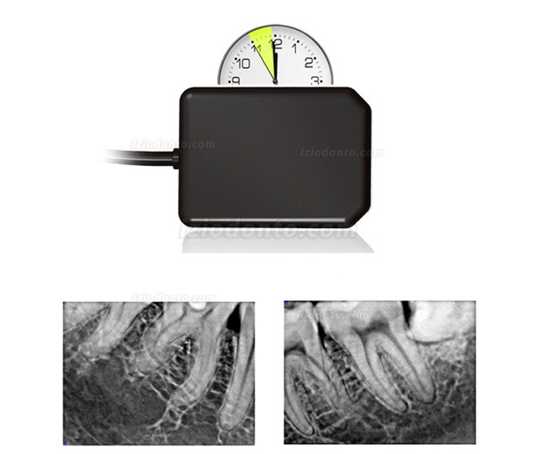 Raio x Odontologico Digital Portati AD-60P + Handy HDR 500 Sensor Para Radiografia