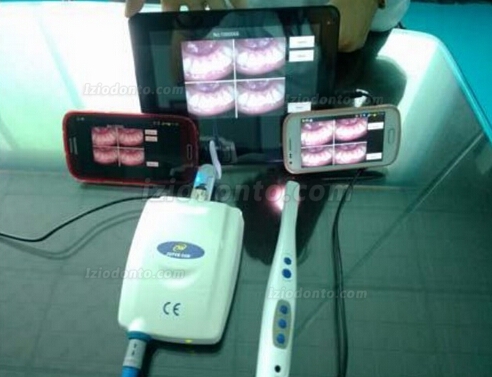 MLG® 1/4 SONY CCD Odontológico Câmera Intra Oral M-888 Com WIFI Livres