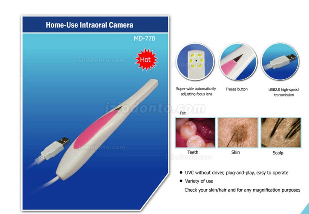 Magenta® MD770 Câmera oral intraoral mini USB de 1,3 megapixels