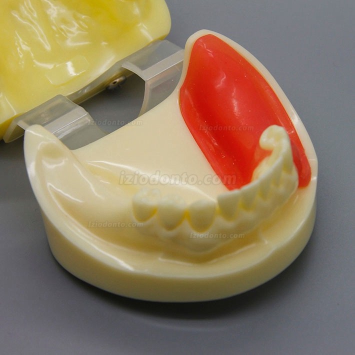 Modelo de prática de cirurgia de implante dentário com gengiva substituível 2002