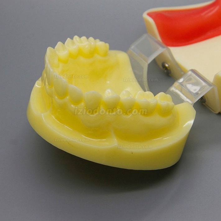 Modelo de prática de cirurgia de implante dentário com gengiva substituível 2002