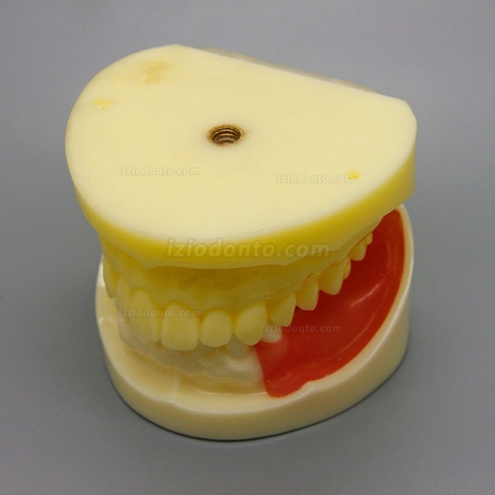 Modelo de prática de cirurgia de implante dentário com gengiva substituível 2002