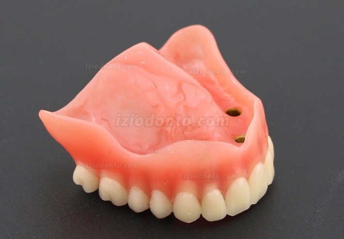 Dentes dentais modelo sobredentadura Superior com 4 implantes 6001