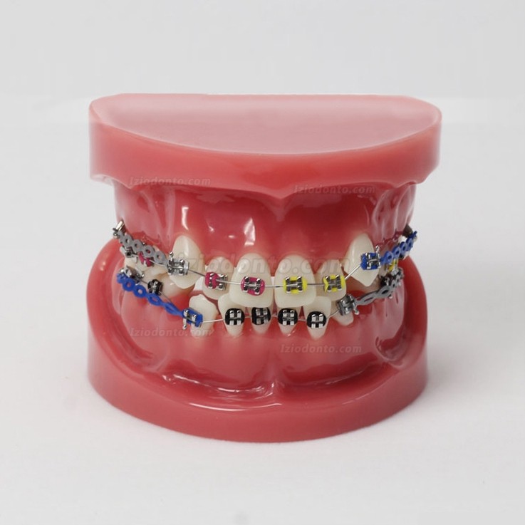 Maloclusão dentária corrigida com suporte dentário modelo padrão M3005