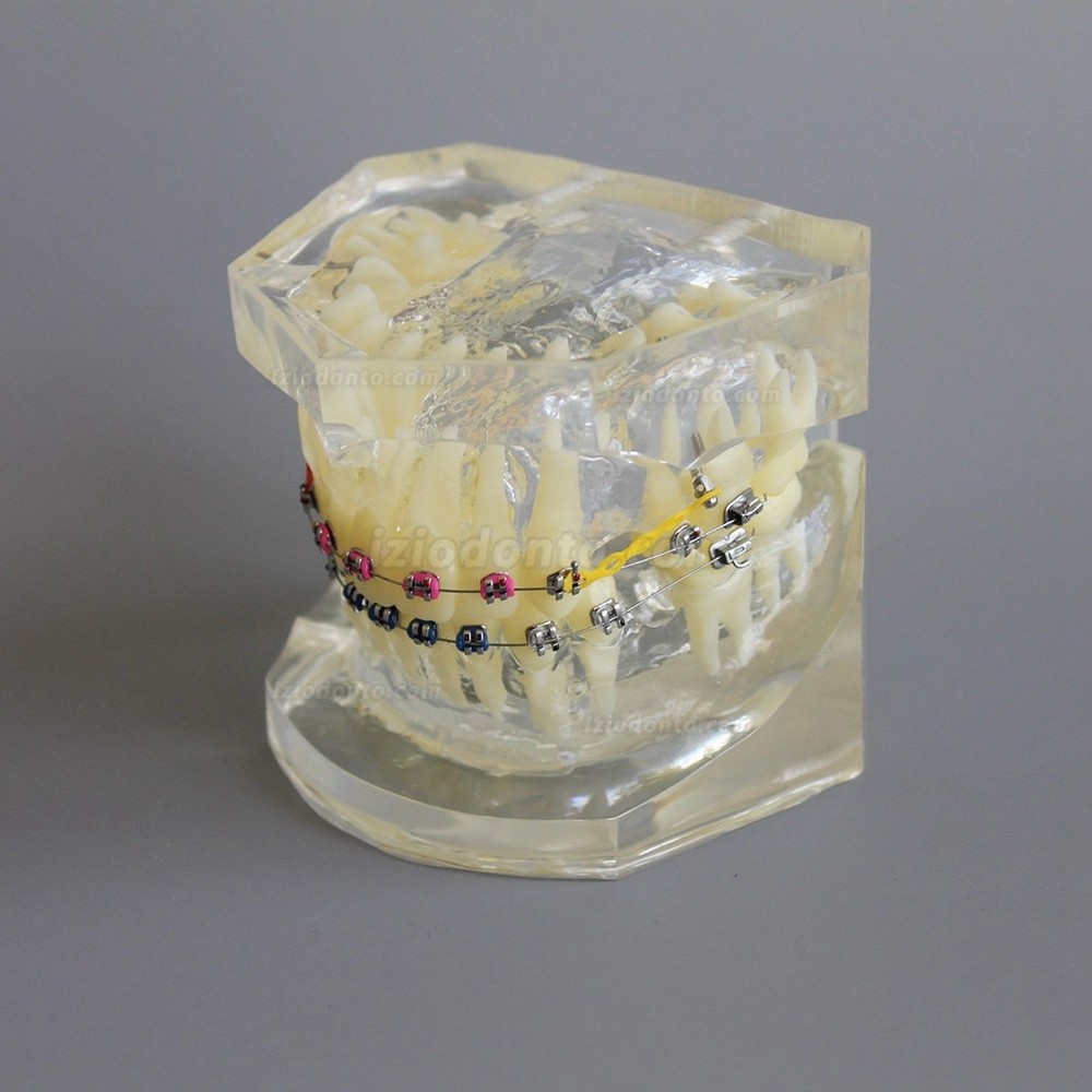 Modelo de prática de demonstração de ortodontia dentária com arco de suporte de metal