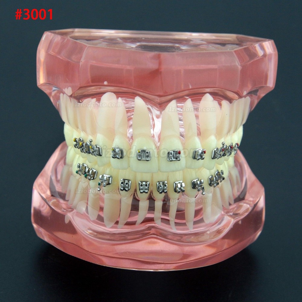 Modelo de Dentes de Prática de Demonstração de Tratamento Ortodôntico Odontológico