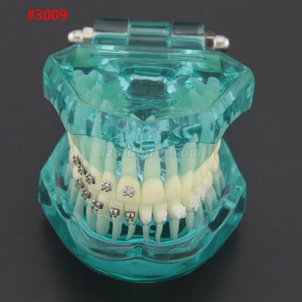 Modelo de Dentes de Prática de Demonstração de Tratamento Ortodôntico Odontológico