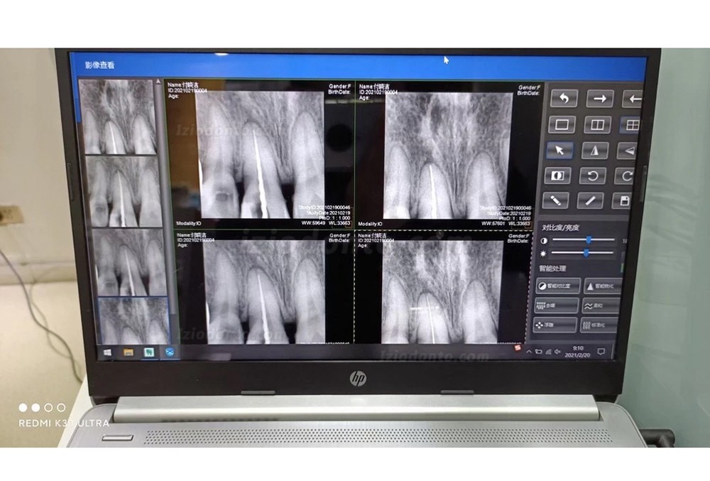 Sensor Para Radiografia Odontológica RVG Sensores Intraorais
