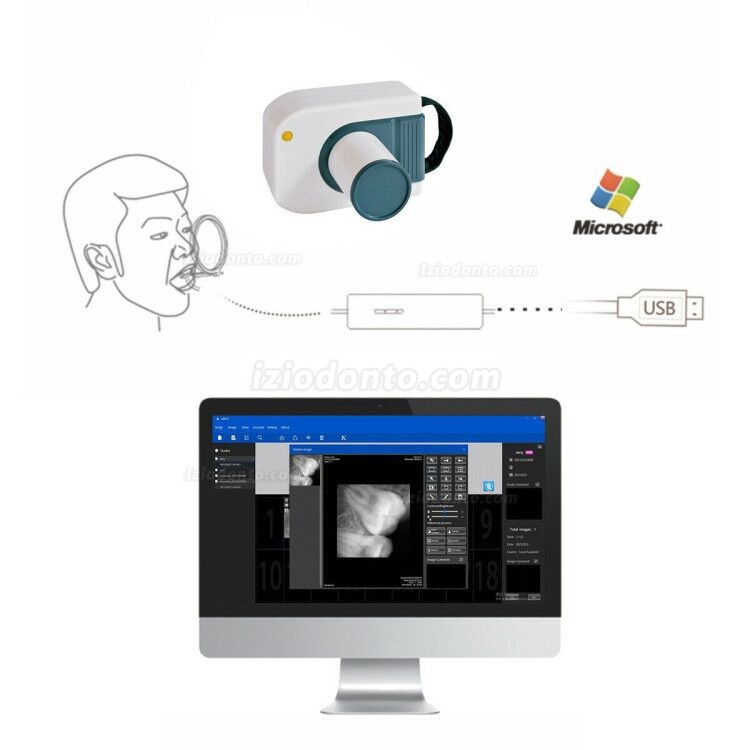 Sensor Para Radiografia Odontológica RVG Sensores Intraorais