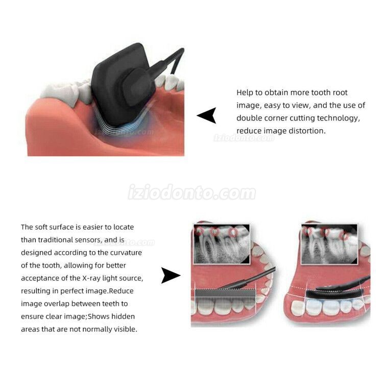 Sensor Para Radiografia Odontológica RVG Sensores Intraorais