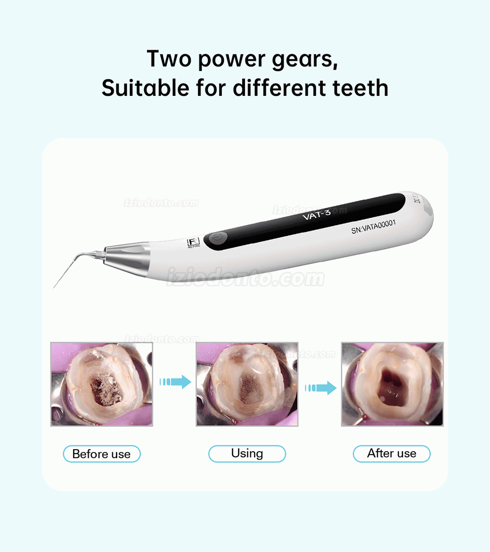 REFINE VAT-3 Ativador ultrassônico dental endoativador Irrigador de canal radicular sem fio