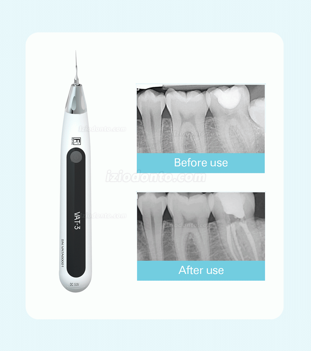 REFINE VAT-3 Ativador ultrassônico dental endoativador Irrigador de canal radicular sem fio